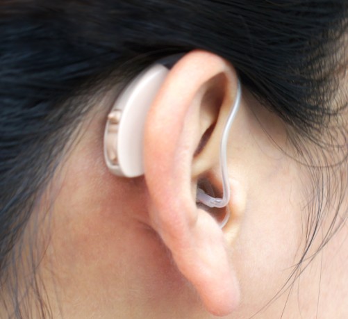 成人配戴助听器的后期适应过程