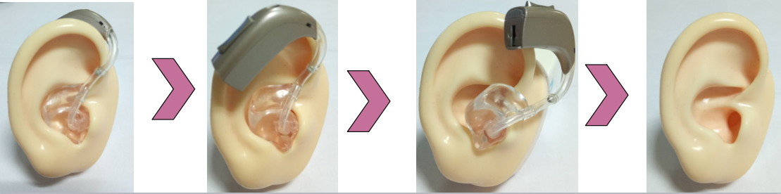耳背式助听器的安装方法和步骤